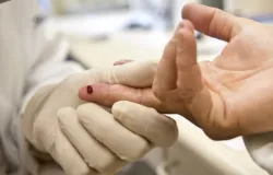 Casos de sfilis e de HIV/aids aumentam entre homens jovens