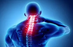 Dor na coluna: quando a cirurgia � indicada