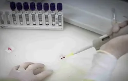 Exames negam ebola em imigrante do Congo