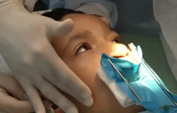 Tratamento de fissura no l�bio e c�u da boca precisa come�ar cedo e contar com v�rios especialistas