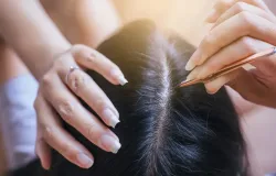 Arrancar cabelo branco faz nascer mais fios? Dermatologista esclarece