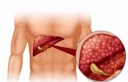 Campanha Julho Amarelo refor�a o combate �s hepatites virais em todo o Brasil