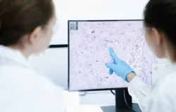 Novo rem�dio contra linfoma � aprovado pela Anvisa