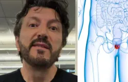 Influenciador Lito Sousa tem c�ncer de pr�stata: entenda a doen�a e o tratamento