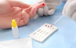 Estudo de Porto Alegre mostra atraso no diagn�stico de HIV entre heterossexuais casados