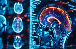 Demora para diagnosticar esclerose m�ltipla agrava a doen�a, alerta associa��o