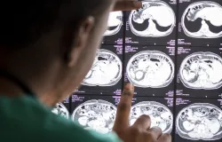 Mais exames n�o significam mais preven��o, alerta m�dico
