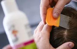 Guia definitivo: piolhos n�o voam e como se livrar deles de vez