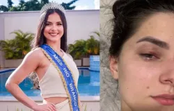 Homem � culpado por bater em antiga rainha de beleza do Acre por ci�mes