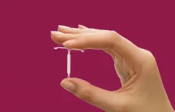 Planos de sa�de passam a obrigatoriamente cobrir DIU hormonal para endometriose