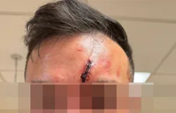 Ladr�es atacamem marido com marretas e amea�am matar beb� de esposa gr�vida em sequestro virtual