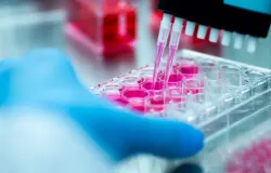 T�cnica de laborat�rio morre em Sib�ria com suspeita de peste e 197 pessoas entram em quarentena