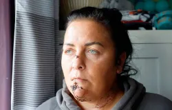 Ataques de c�es deixam m�e com o rosto destru�do e adolescente com l�bio pendurado na Esc�cia
