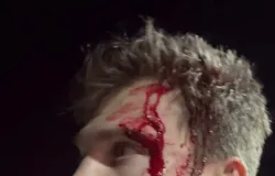 Ator da s�rie 'As Meninas que Gritam' � agredido com arma e faca em Los Angeles