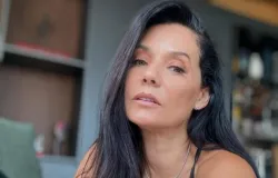 M�nica Carvalho mostra rosto ap�s harmoniza��o facial ao vivo na TV e surpreende