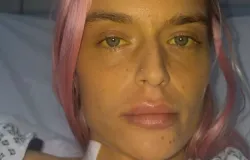 Viciada em drogas quase morre e fica com bexiga do tamanho de uma colher de ch�