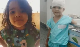 Menina de 4 anos � atacada na cabe�a por pit-bull