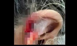 Neto arranca peda�o da orelha da av� e confessa que engoliu