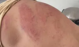 Homem � sequestrado e torturado por criminosos do Comando Vermelho em Mato Grosso