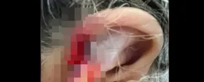 Neto morde e arranca um peda�o da orelha da av� e diz � pol�cia que engoliu