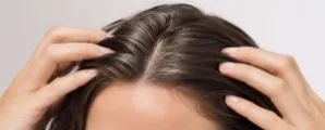 Precisa cortar ou raspar o cabelo para fazer lifting facial?