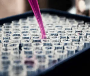 Exame de sangue simples pode detectar doen�as silenciosas
