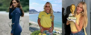 Virginia, Bruna Biancardi, Karoline Lima e mais: cirurgi�o analisa os procedimentos das musas que est�o dominando a Copa