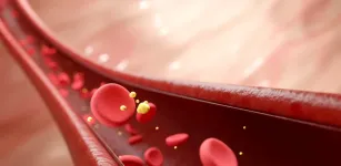 Coma esses 5 alimentos para baixar o colesterol ruim