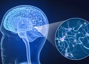 Esclerose m�ltipla: condi��o complexa para m�dicos e pacientes afeta milhares de pessoas no pa�s