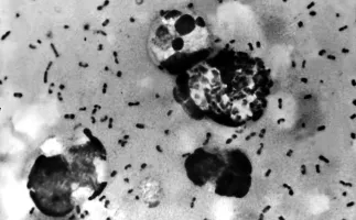 Morte de cientista em laborat�rio de peste na Sib�ria gera alerta nos EUA
