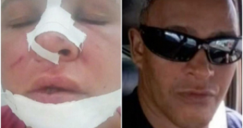 Marido quebra nariz de esposa na frente de crianas em VG