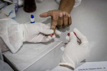 Mato Grosso registra 73.115 casos e 2.377 bitos por Covid-19