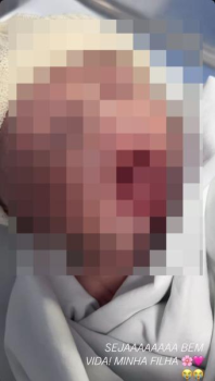 Beb brutalmente arrancada de ventre de adolescente passa bem e est aos cuidados do pai