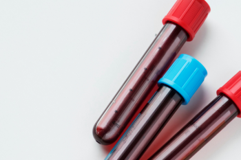Multinacional japonesa Fujirebio Diagnostics desenvolveu um teste com exame de sangue para detectar Alzheimer