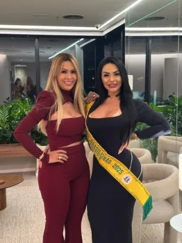 Musa do Brasileir�o e do Flamengo faz harmoniza��o definitiva com PMMA para corrigir assimetria na face