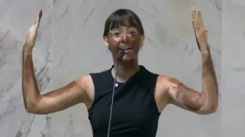 Deputada Fabiana Bolsonaro faz 'blackface' em protesto transf�bico