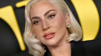 Lady Gaga cancela show por motivos de sa�de: "O meu estado piorou"