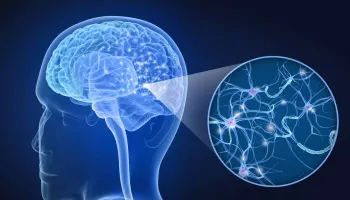 Esclerose m�ltipla: condi��o complexa para m�dicos e pacientes afeta milhares de pessoas no pa�s
