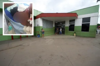 Funcion�rio de fazenda tem rosto dilacerado por on�a-pintada