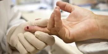 Casos de sfilis e de HIV/aids aumentam entre homens jovens
