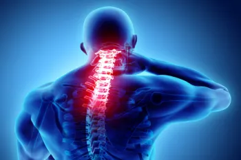 Dor na coluna: quando a cirurgia � indicada
