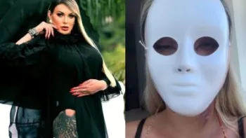 Andressa Urach mostra novo rosto ap�s 50� cirurgia pl�stica
