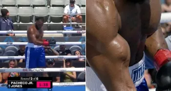 Boxeador Nick Jones sofre contus�o rara e grave: ruptura de b�ceps (Foto: Reprodu��o/X)