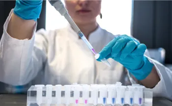 Glofitamabe demonstrou reduzir em 41% o risco de morte e 50,3% dos pacientes que receberam o novo esquema alcan�aram a remiss�o completa da doen�a