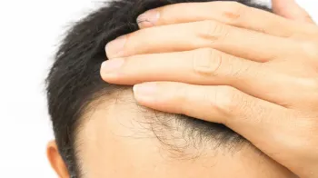 iStock