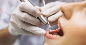Sistema analisa radiografias panor�micas e oferece uma 'segunda opini�o' para cirurgi�es-dentistas. Foto: Freepik