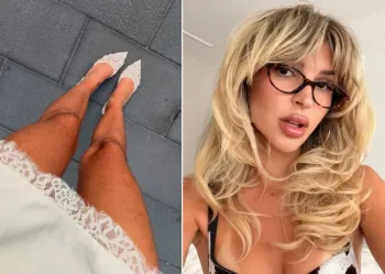 Empres�ria e modelo canadense Elisabeth Rioux reagiu ap�s pelos nas suas pernas viralizarem: 'O corpo � MEU' Foto: Reprodu��o/Instagram