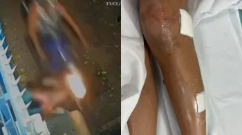 Moto em alta velocidade atingiu a menina quando ela sa�a da escola de dan�a - Reprodu��o/Redes Sociais / Arquivo pessoal