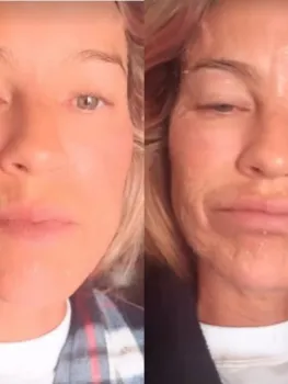 Luana Piovani realizou procedimento a laser no rosto - Reprodu��o/Instagram