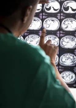 Neurologista analisando raio x Foto: Freepik
